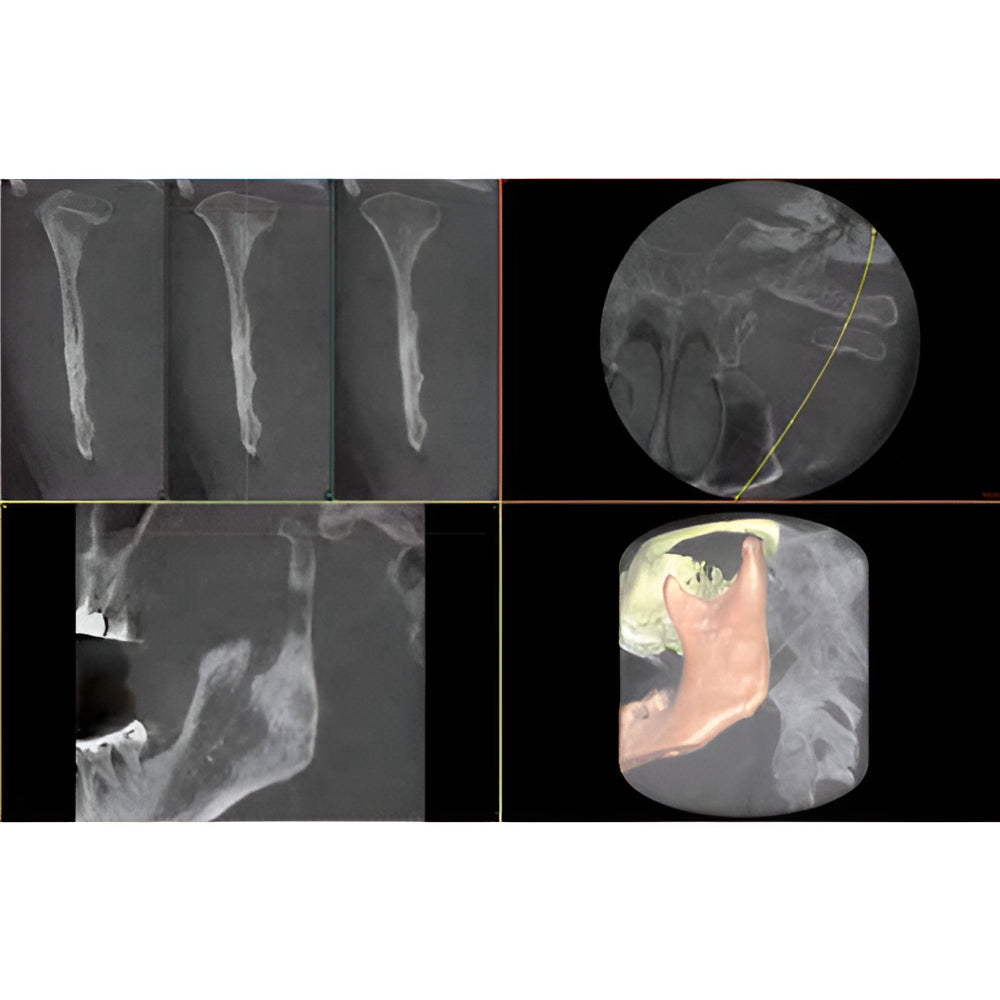 Owandy iMax Touch Pan + CBCT