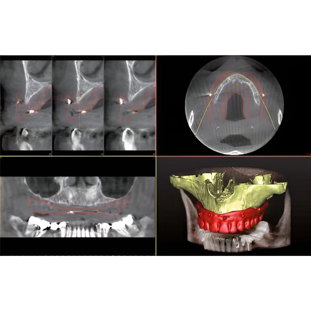 Owandy iMax Touch Pan + CBCT