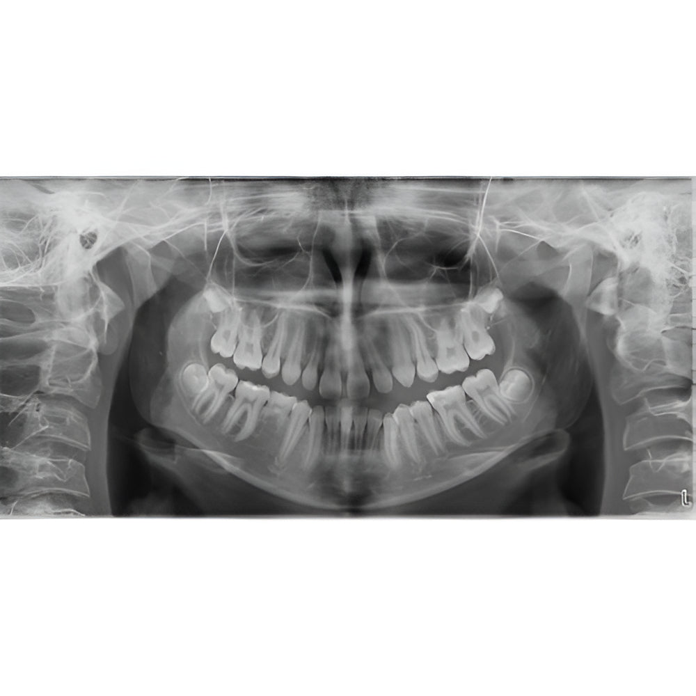 Planmeca ProMax Pan