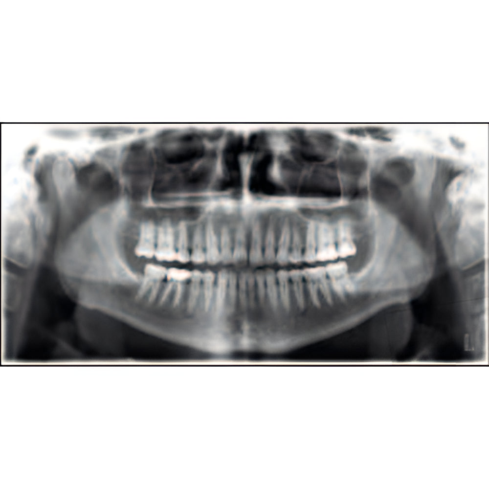 Planmeca ProMax Pan