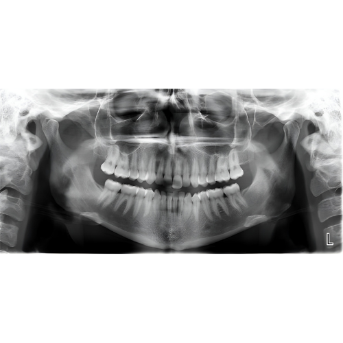 Planmeca ProMax Pan + Ceph + CBCT (8x8 FOV) with PC, Software, Installation, Shipping and Warranty