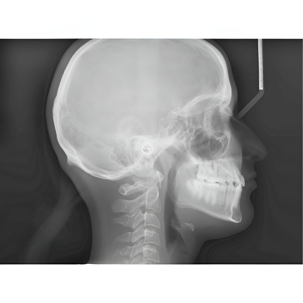 Planmeca ProMax Pan + Ceph + CBCT (8x8 FOV) with PC, Software, Installation, Shipping and Warranty