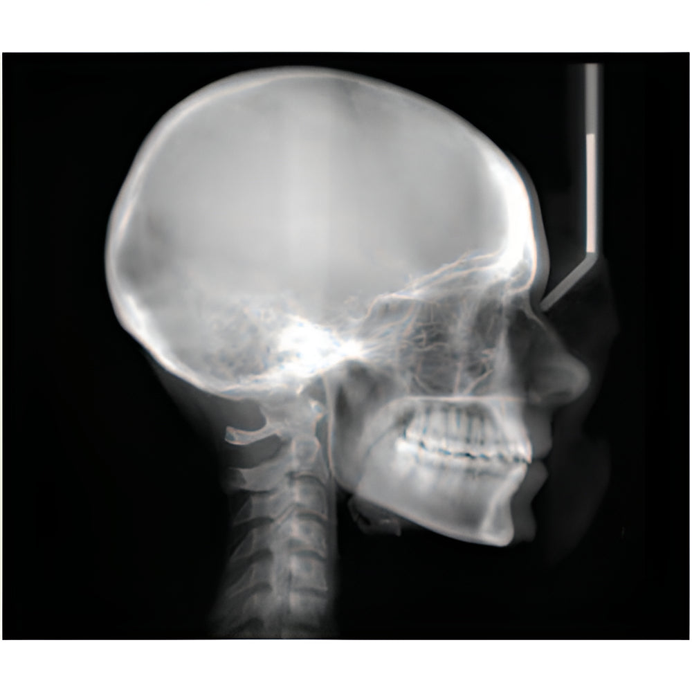 Planmeca ProMax Pan + Ceph + CBCT (8x8 FOV) with PC, Software, Installation, Shipping and Warranty