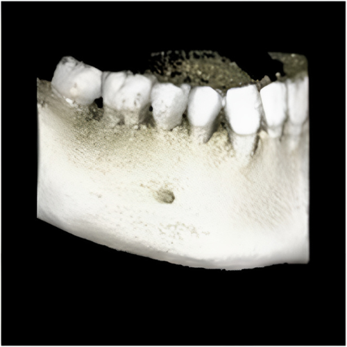 Planmeca ProMax Pan + Ceph + CBCT (8x8 FOV)