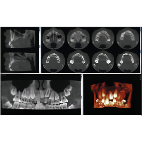 Planmeca ProMax Mid Pan + CBCT (20x17 FOV)