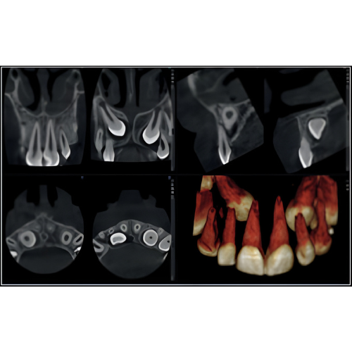 Planmeca ProMax Mid Pan + CBCT (20x17 FOV)