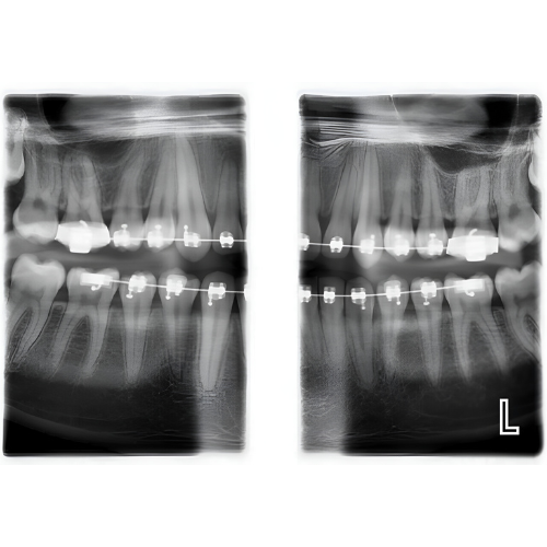 Planmeca ProMax Mid Pan + CBCT (20x17 FOV)