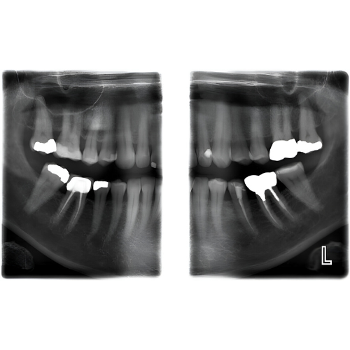 Planmeca ProMax Mid Pan + CBCT (20x17 FOV)
