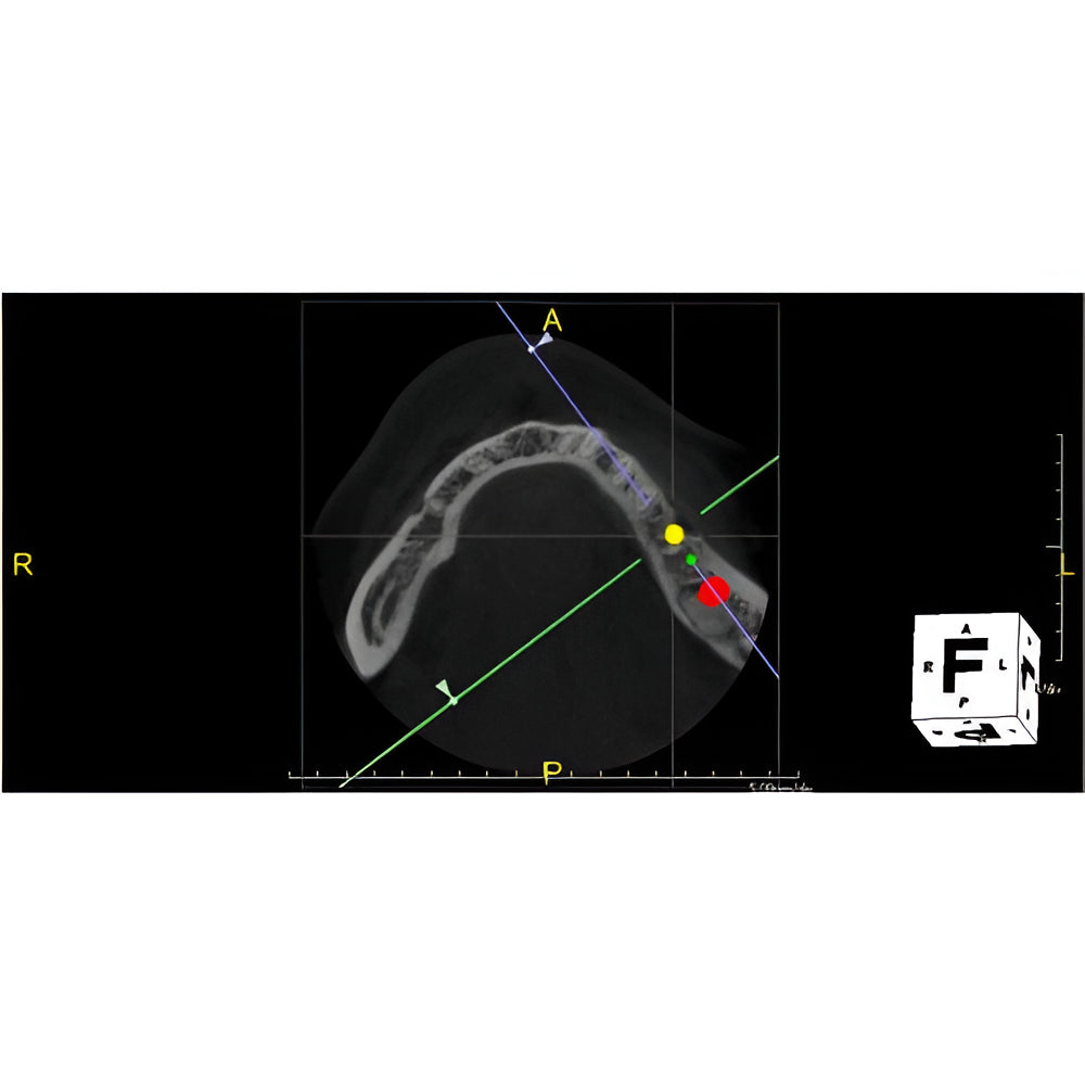 PreXion Excelsior Pan + CBCT (15x8 FOV)