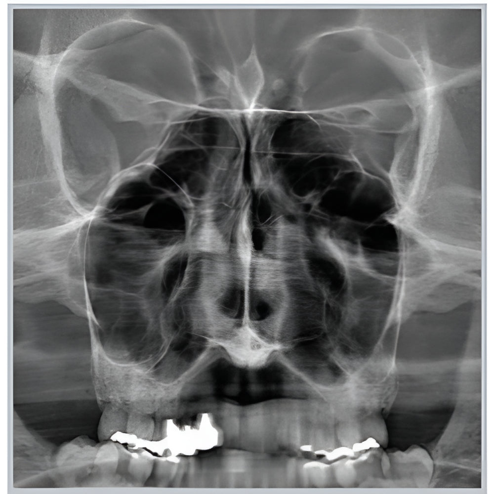 RayScan Alpha Expert Pan + CBCT (9x9 FOV)
