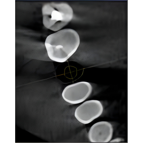 Sirona Galileos Comfort CBCT (15x15 FOV)
