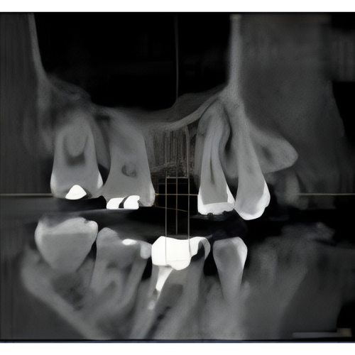 Sirona Galileos Comfort CBCT (15x15 FOV)
