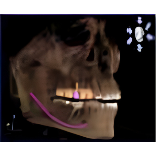 Sirona Galileos Comfort CBCT (15x15 FOV)