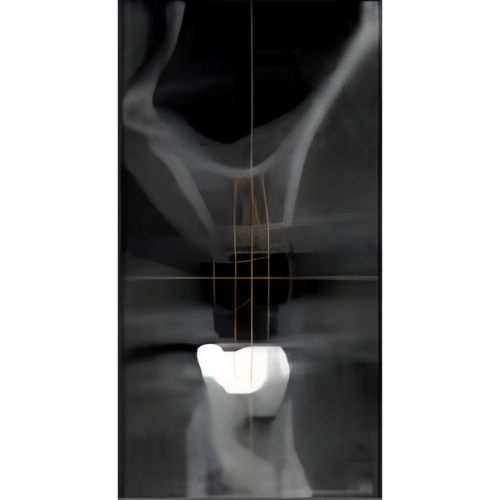 Sirona Galileos Comfort CBCT (15x15 FOV)