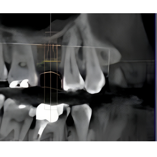 Sirona Galileos Comfort CBCT (15x15 FOV)