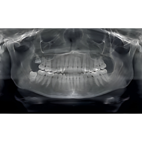 Sirona Galileos Comfort CBCT (15x15 FOV)