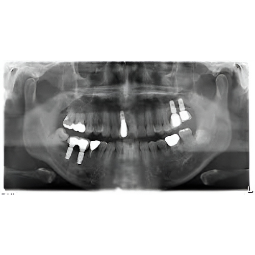 Sirona Orthophos XG Pan + Ceph