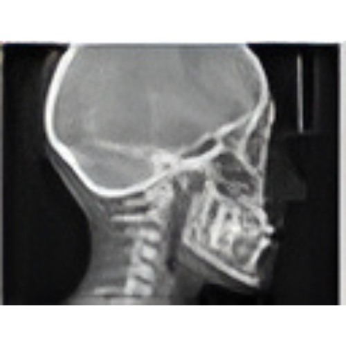 Sirona Orthophos XG Pan + Ceph