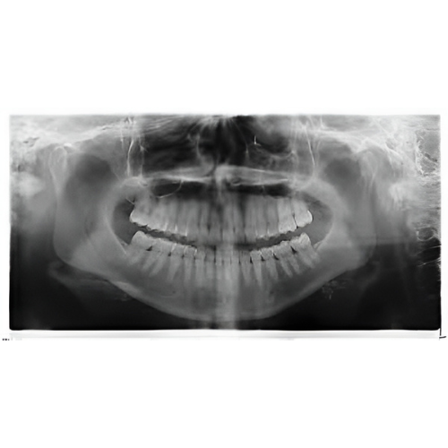 Sirona Orthophos XG Pan + Ceph