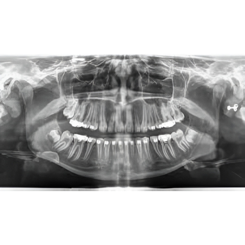 Sirona Orthophos XG Pan + Ceph