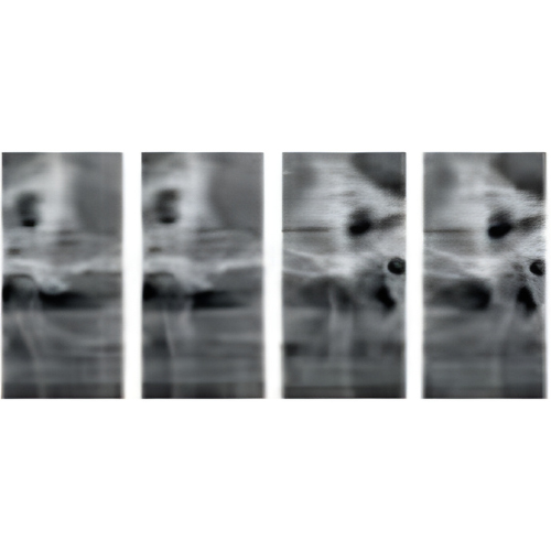 Sirona Orthophos XG Pan + CBCT (8x8 FOV)