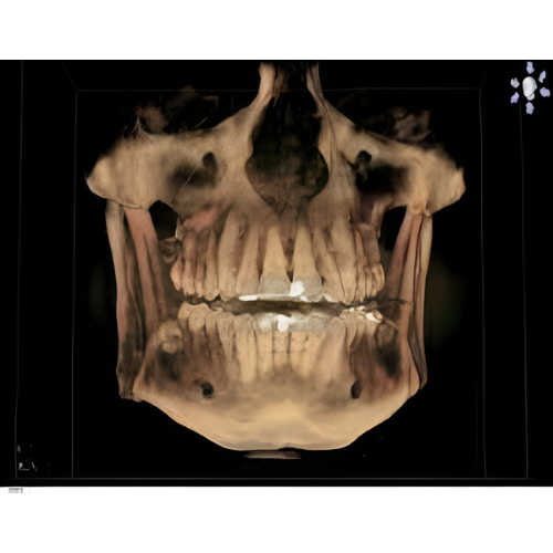 Sirona Orthophos XG Pan + CBCT (8x8 FOV)