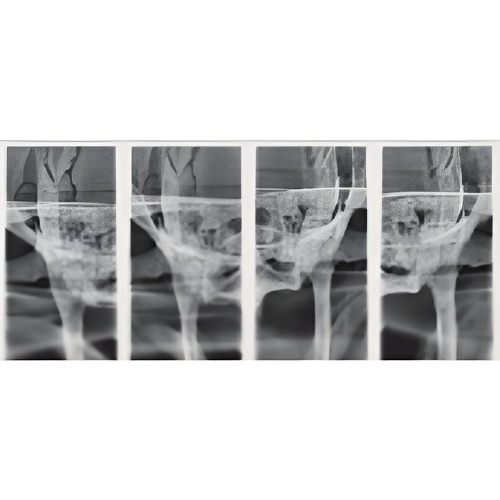 Sirona Orthophos XG Pan + CBCT (8x8 FOV)