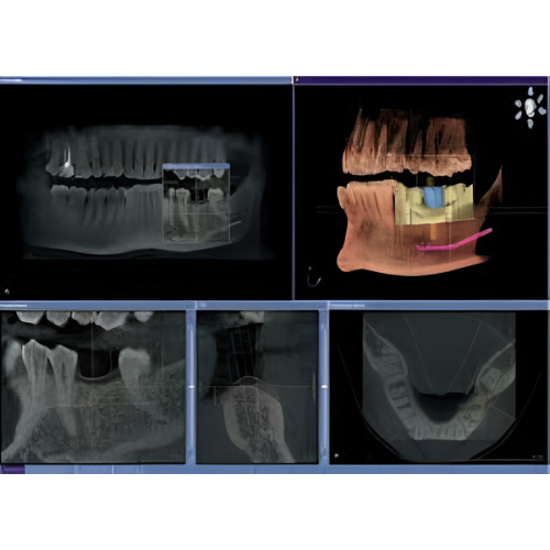 Sirona Orthophos XG Pan + CBCT (8x8 FOV)