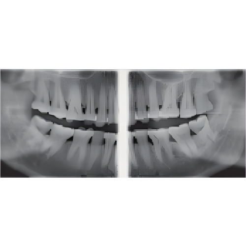 Sirona Orthophos XG Pan + CBCT (8x8 FOV)