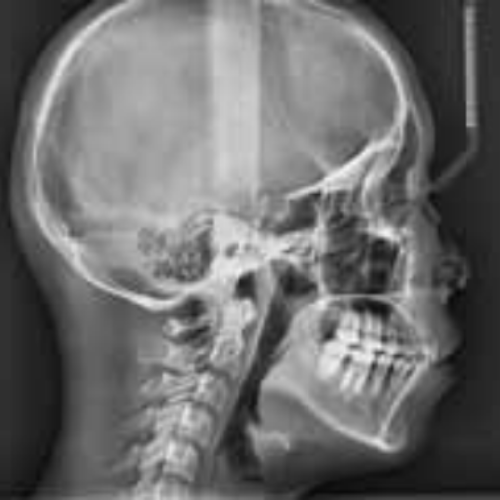 Vatech PaX-i 3D Pan +Ceph + CBCT (12x9 FOV)