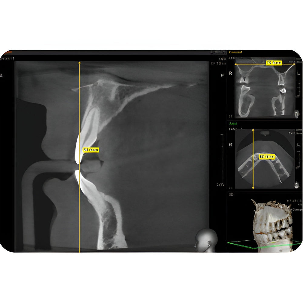 Vatech PaX-i3D Pan + CBCT (8x8 FOV)