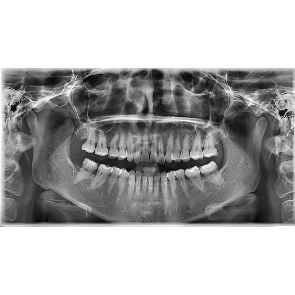 Vatech PaX-i3D Pan + CBCT (8x8 FOV)