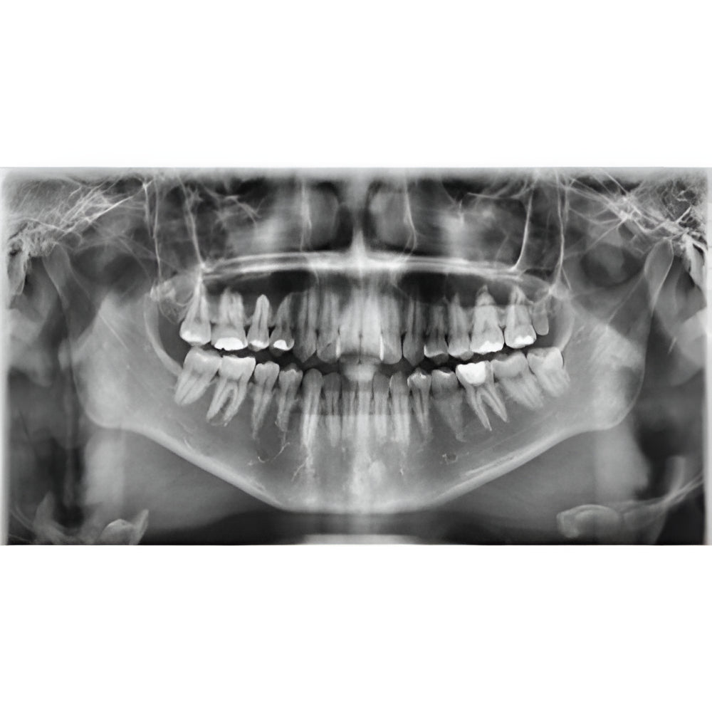 Vatech PaX-i3D Pan + CBCT (8x8 FOV)