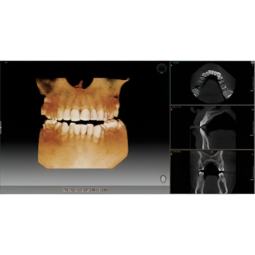 Vatech PaX-i3D Pan + CBCT (8x8 FOV)