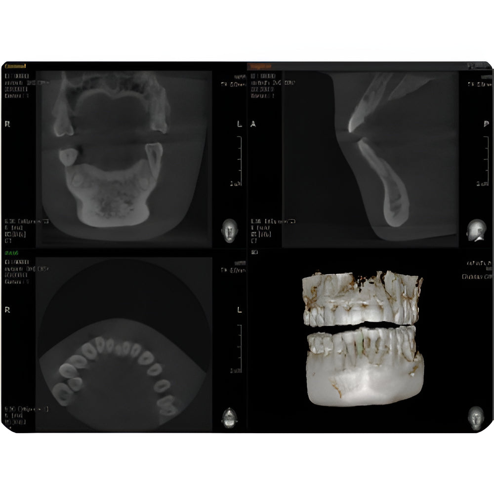 Vatech PaX-i3D Pan + CBCT (8x8 FOV)