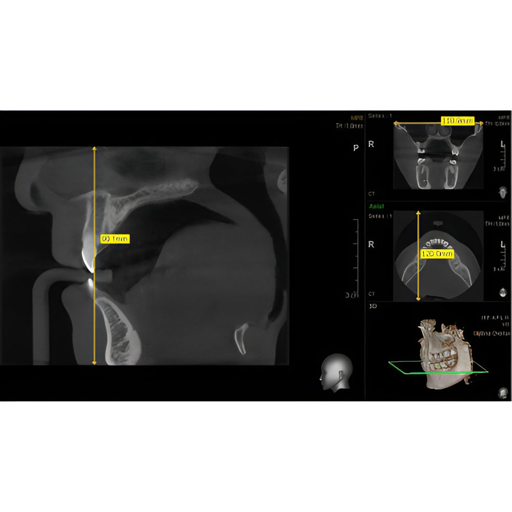 Vatech PaX-i3D Pan + CBCT (8x8 FOV)
