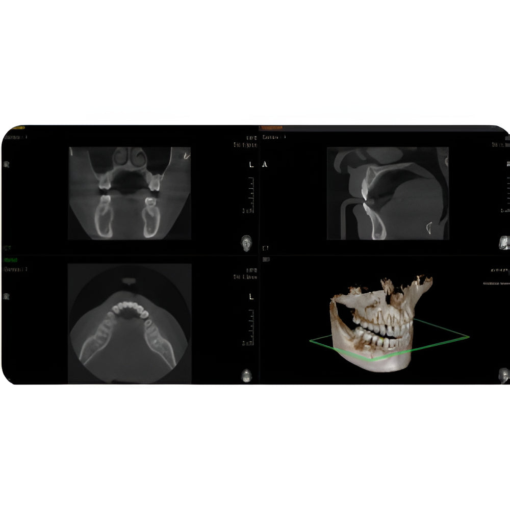 Vatech PaX-i3D Pan + CBCT (8x8 FOV)