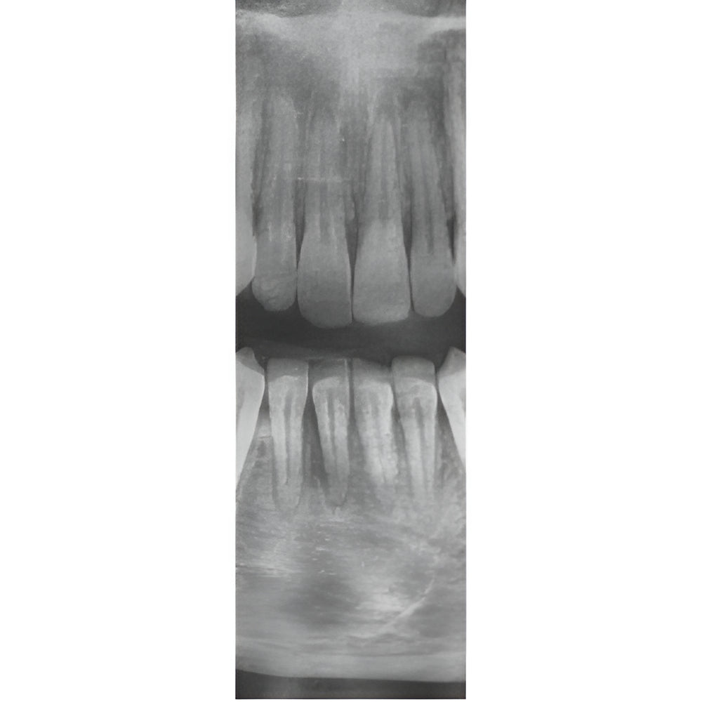 Vatech PaX-i3D Pan + CBCT (8x8 FOV)