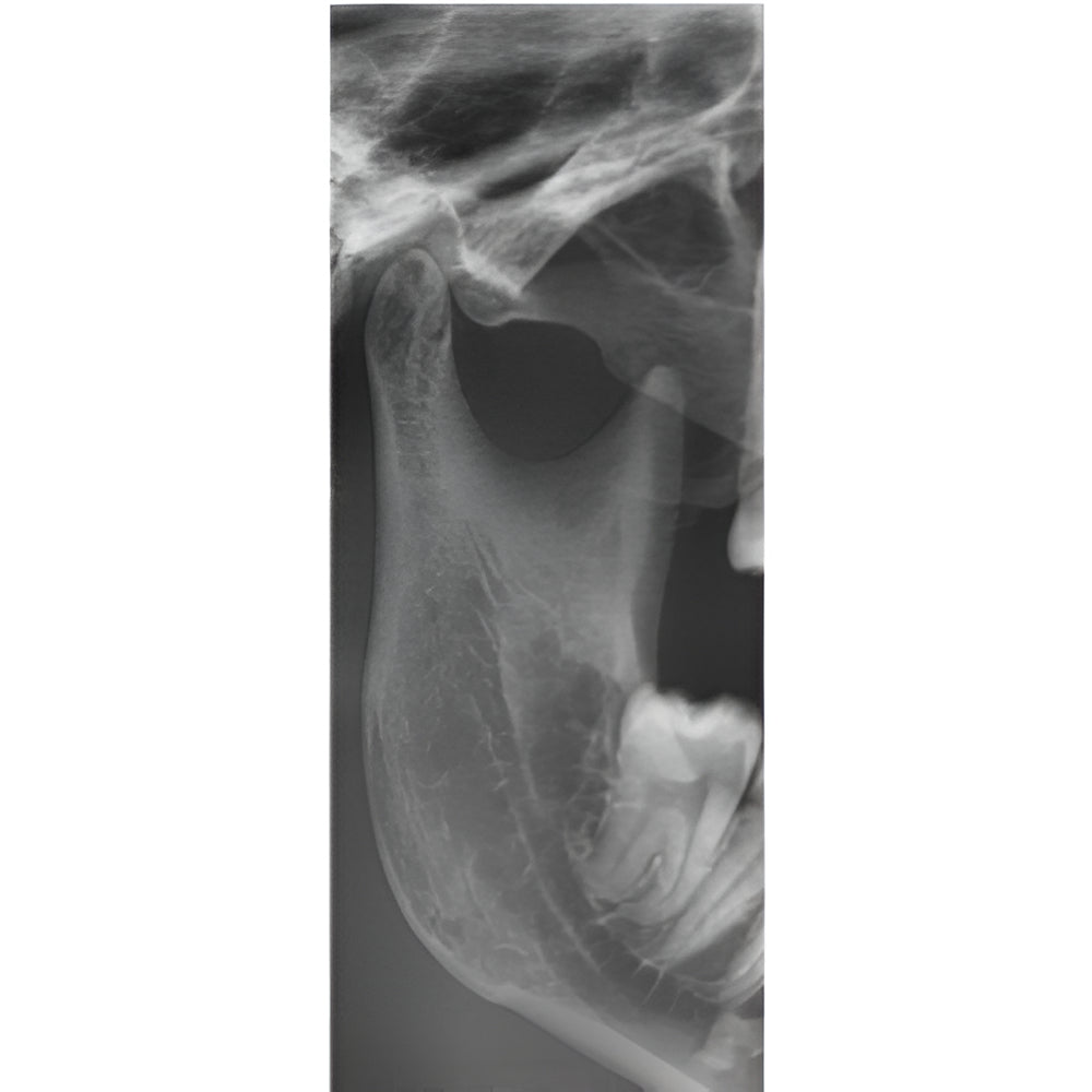 Vatech PaX-i3D Pan + CBCT (8x8 FOV)