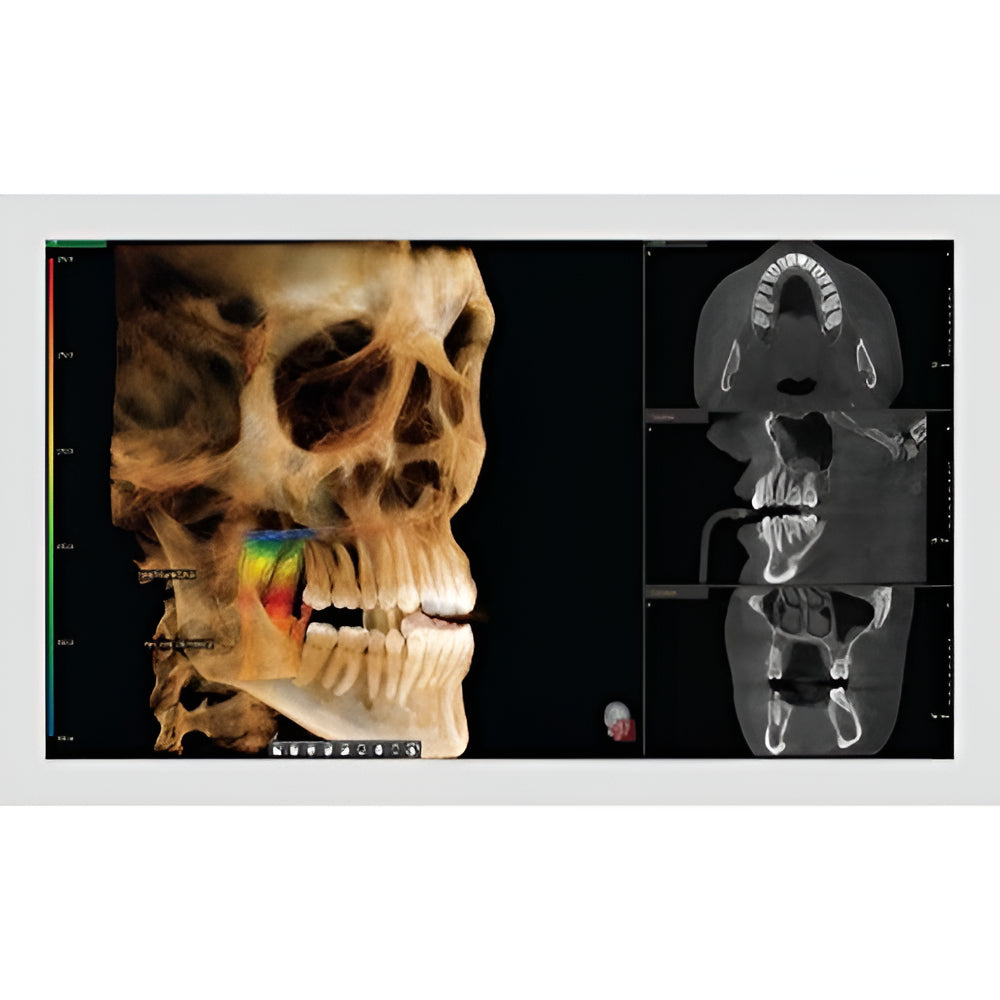 Vatech PaX-i Green CT Pan + CBCT (12x9 FOV)