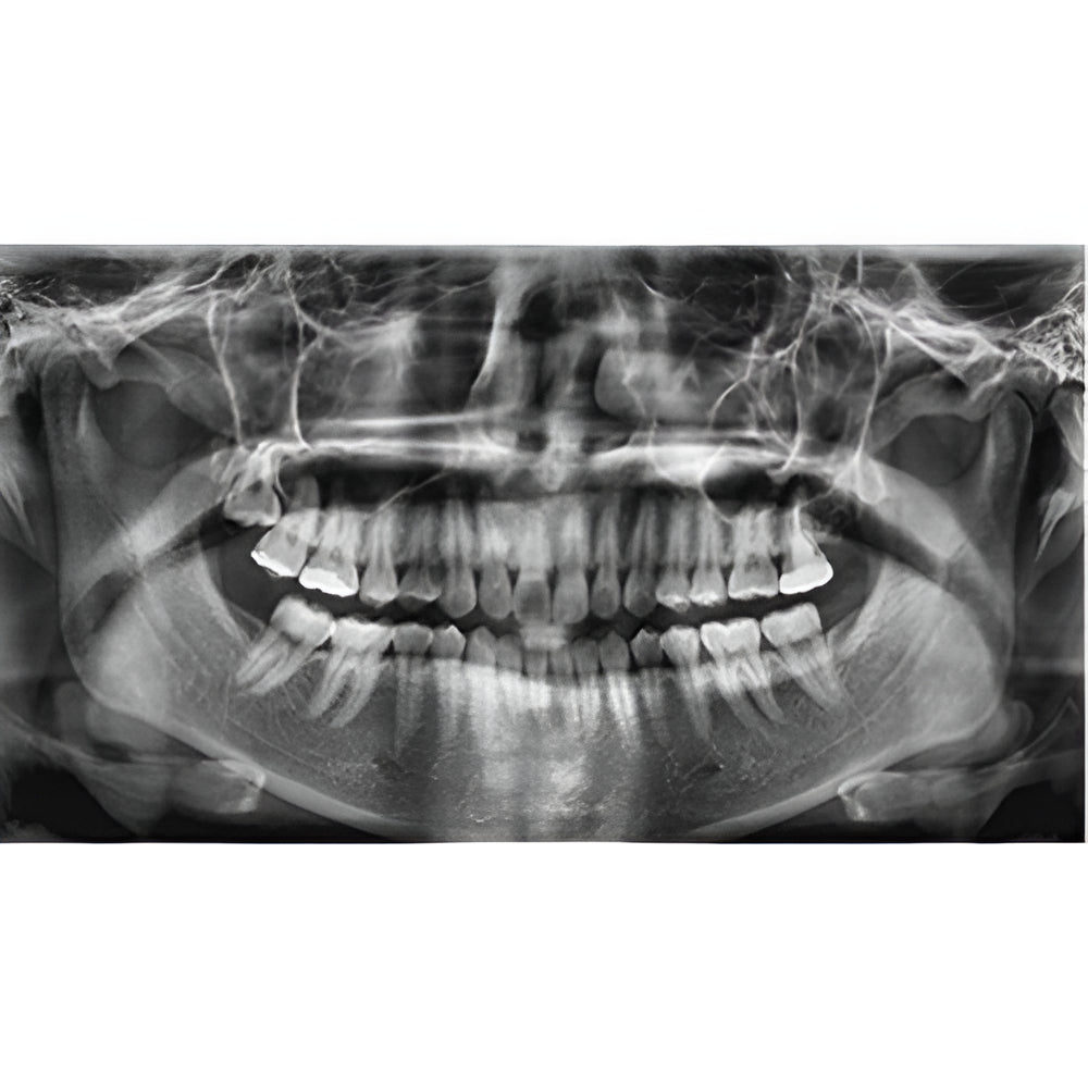 Vatech PaX-i Pan + CBCT (8x8 FOV)