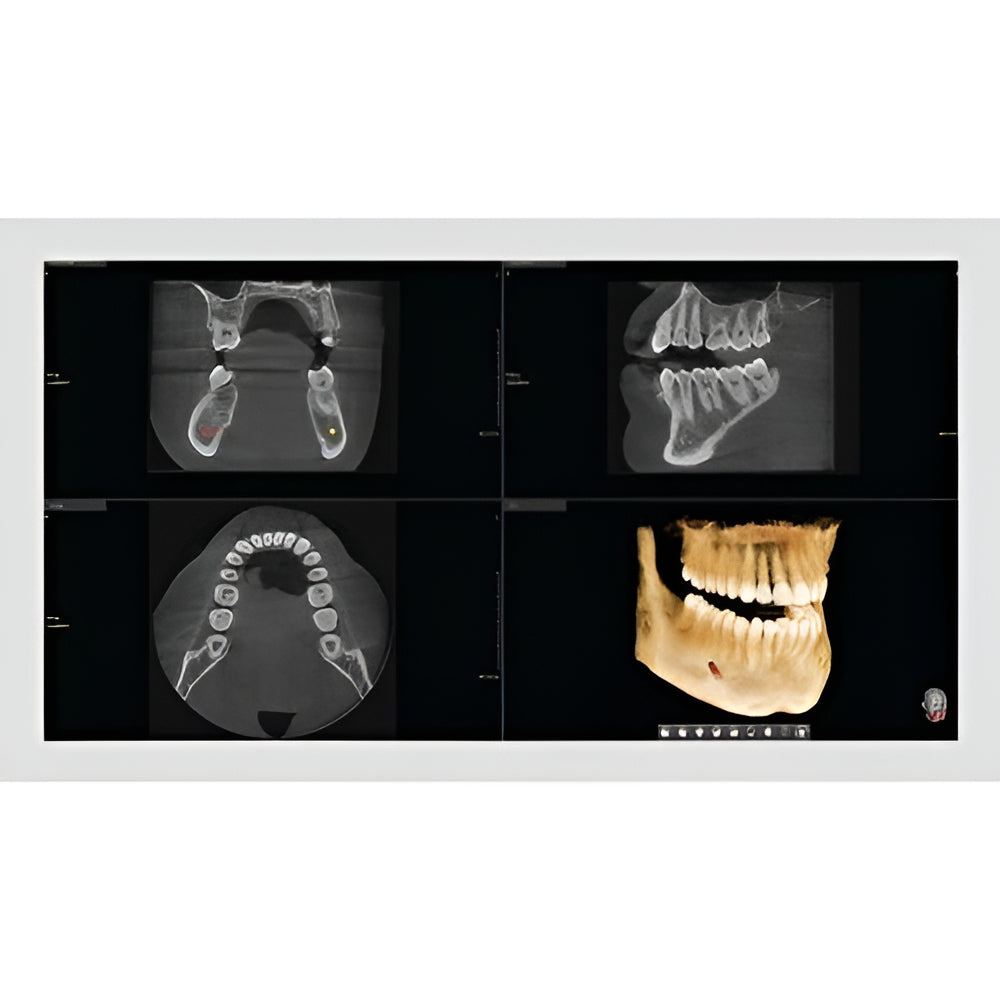Vatech PaX-i Green CT Pan + CBCT (12x9 FOV)