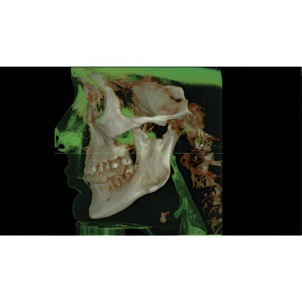 Vatech PaX-i Green CT Pan + CBCT (12x9 FOV)