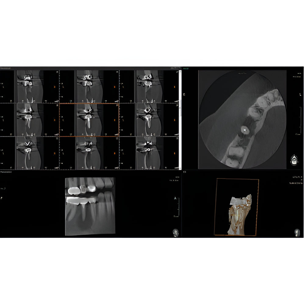 Vatech PaX-i Green CT Pan + CBCT (12x9 FOV)