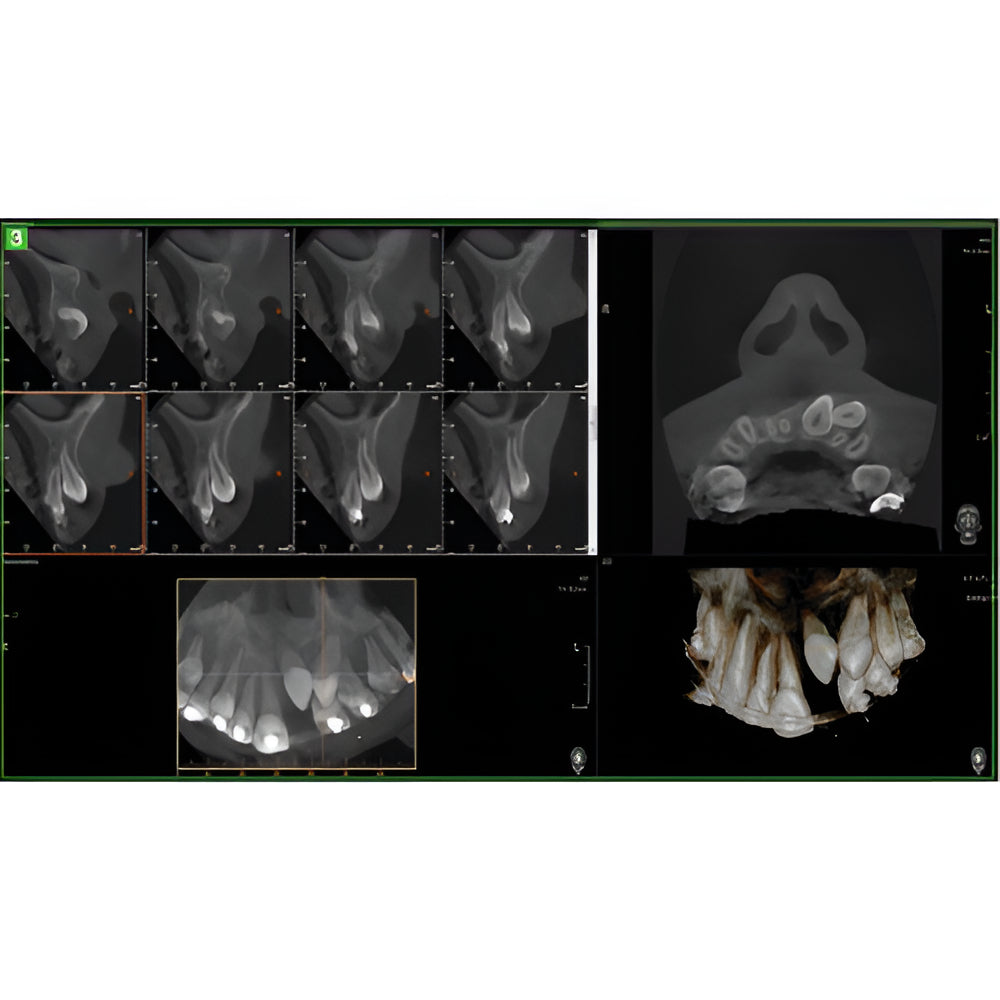 Vatech PaX-i Green CT Pan + CBCT (12x9 FOV)