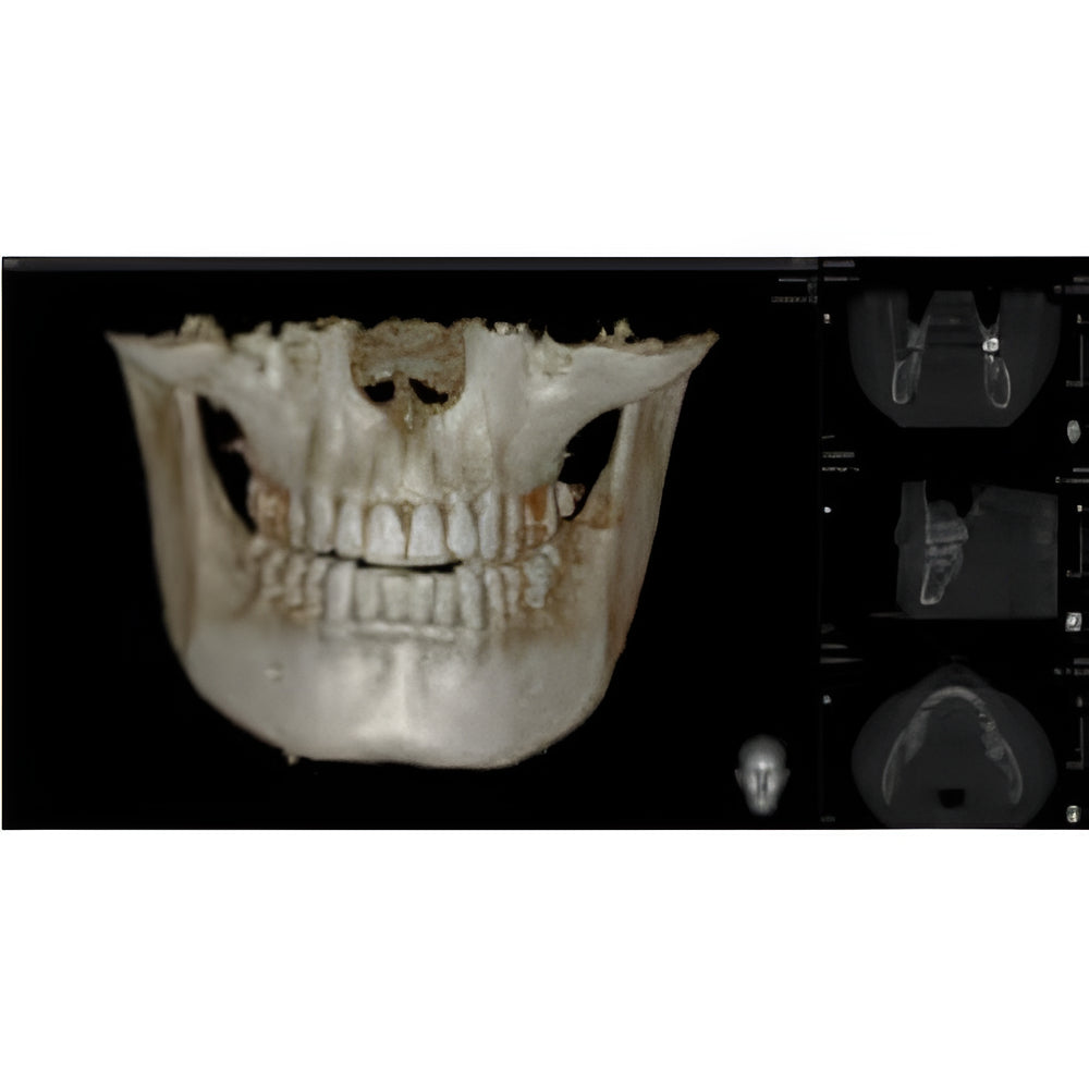 Vatech PaX-i Green CT Pan + CBCT (12x9 FOV)
