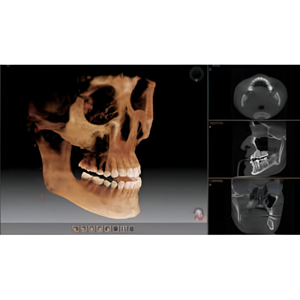 Vatech PaX-i Green CT Pan + CBCT (12x9 FOV)