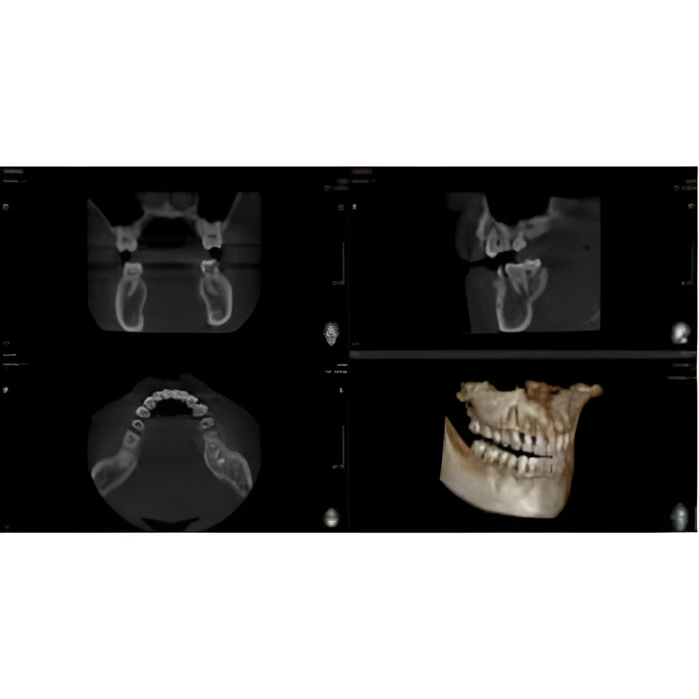 Vatech PaX-i Green CT Pan + CBCT (12x9 FOV)