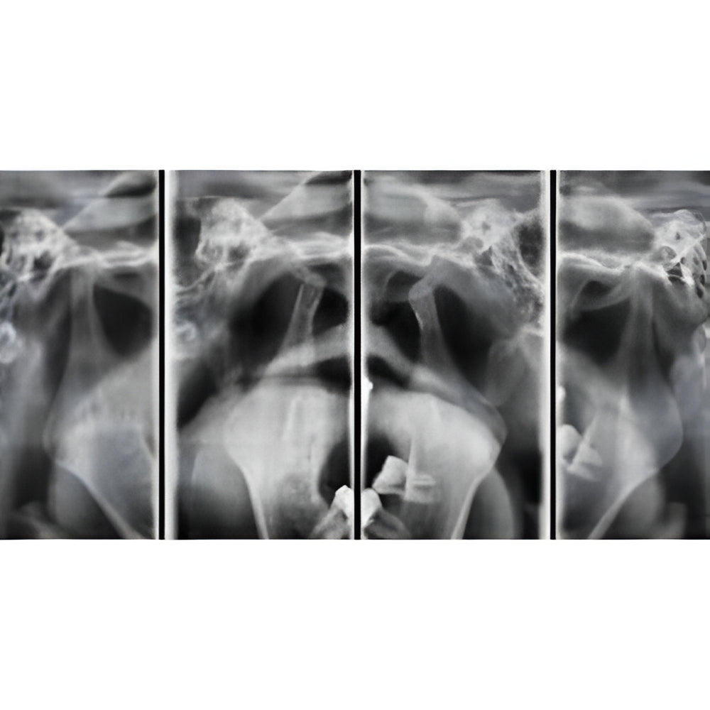 Vatech PaX-i Green CT Pan + CBCT (12x9 FOV)