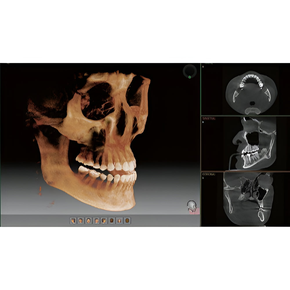Vatech PaX-i Green CT Pan + CBCT (12x9 FOV)